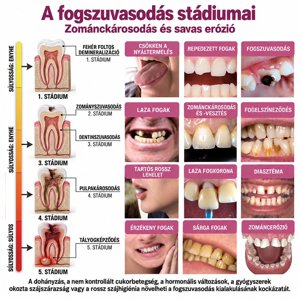 🧚‍♀️☘️🦷HEATWOLF® DenPerm – Természetes fogzománc-töltő gél a fogszuvasodás helyreállítására