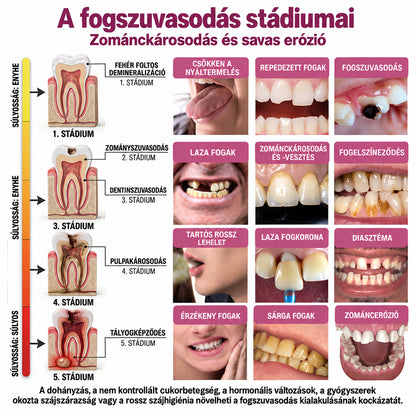 🧚‍♀️☘️🦷HEATWOLF® DenPerm – Természetes fogzománc-töltő gél a fogszuvasodás helyreállítására
