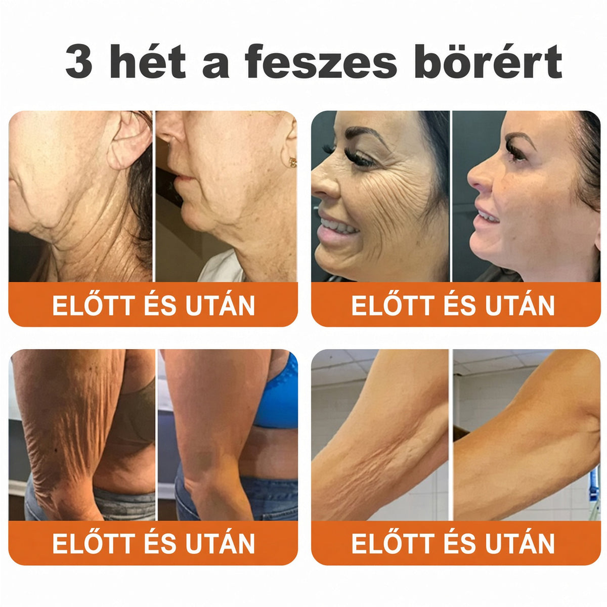 🔥  LIMITÁLT AJÁNLAT 👨‍⚕️🐝🌿 60% KEDVEZMÉNY | CureVivo® Méhméreg Bőrápoló Krém🐟3️⃣