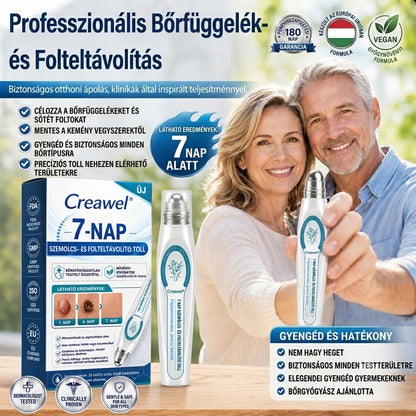 🖋️🌕𝐇𝐢𝐯𝐚𝐭𝐚𝐥𝐨𝐬 𝐦á𝐫𝐤𝐚𝐛𝐨𝐥𝐭  Creawel®   𝟕 𝐍𝐚𝐩𝐨𝐬 𝐁ő𝐫𝐤𝐢𝐧ö𝐯é𝐬- é𝐬 𝐅𝐨𝐥𝐭𝐫𝐚𝐝í𝐫(Fájdalommentes, nyommentes roll-on)