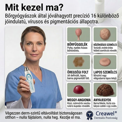 🖋️🌕𝐇𝐢𝐯𝐚𝐭𝐚𝐥𝐨𝐬 𝐦á𝐫𝐤𝐚𝐛𝐨𝐥𝐭  Creawel®   𝟕 𝐍𝐚𝐩𝐨𝐬 𝐁ő𝐫𝐤𝐢𝐧ö𝐯é𝐬- é𝐬 𝐅𝐨𝐥𝐭𝐫𝐚𝐝í𝐫(Fájdalommentes, nyommentes roll-on)