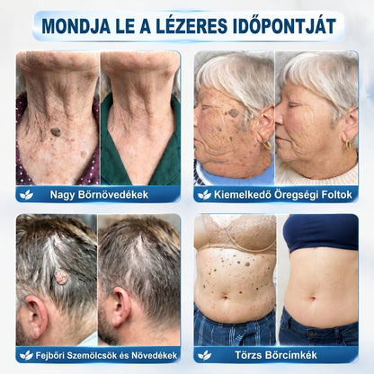 🖋️🌕𝐇𝐢𝐯𝐚𝐭𝐚𝐥𝐨𝐬 𝐦á𝐫𝐤𝐚𝐛𝐨𝐥𝐭  Creawel®   𝟕 𝐍𝐚𝐩𝐨𝐬 𝐁ő𝐫𝐤𝐢𝐧ö𝐯é𝐬- é𝐬 𝐅𝐨𝐥𝐭𝐫𝐚𝐝í𝐫(Fájdalommentes, nyommentes roll-on)