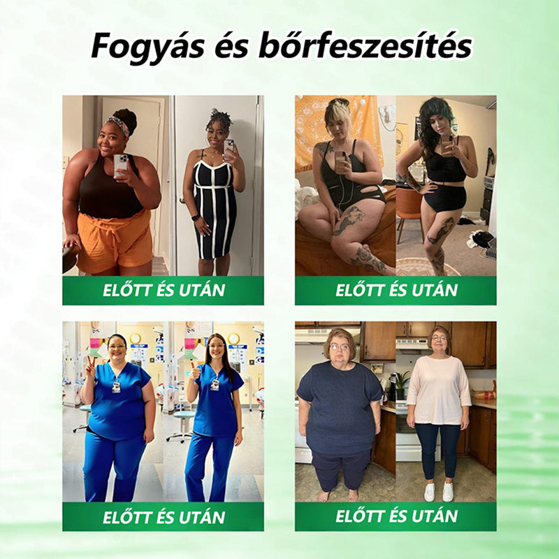 Hivatalos Bolt | 🩹🌞 CureVivo® Moringa · Berberine × NAD+ 10-az-1 Haladó Nano Mikrotű Tapasz (Naponta csak egyszer, látható változás 7 nap alatt) ✅ Elhízás, laza bőr, cukorbetegség, alvási apnoe, ízületi problémák és még több ellen