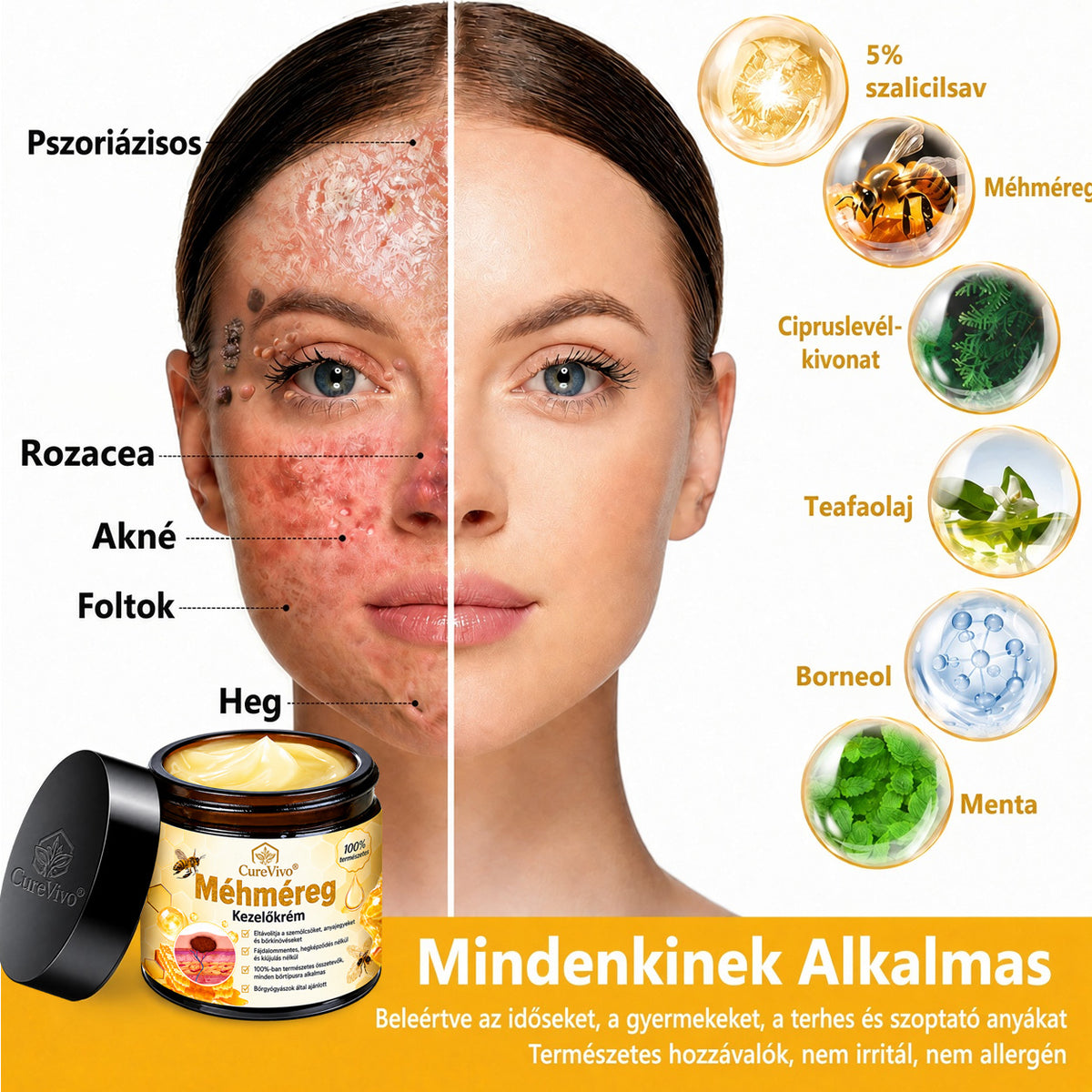 🔥  LIMITÁLT AJÁNLAT 👨‍⚕️🐝🌿 60% KEDVEZMÉNY | CureVivo® Méhméreg Bőrápoló Krém🐟3️⃣