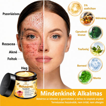🔥  LIMITÁLT AJÁNLAT 👨‍⚕️🐝🌿 60% KEDVEZMÉNY | CureVivo® Méhméreg Bőrápoló Krém🐟3️⃣