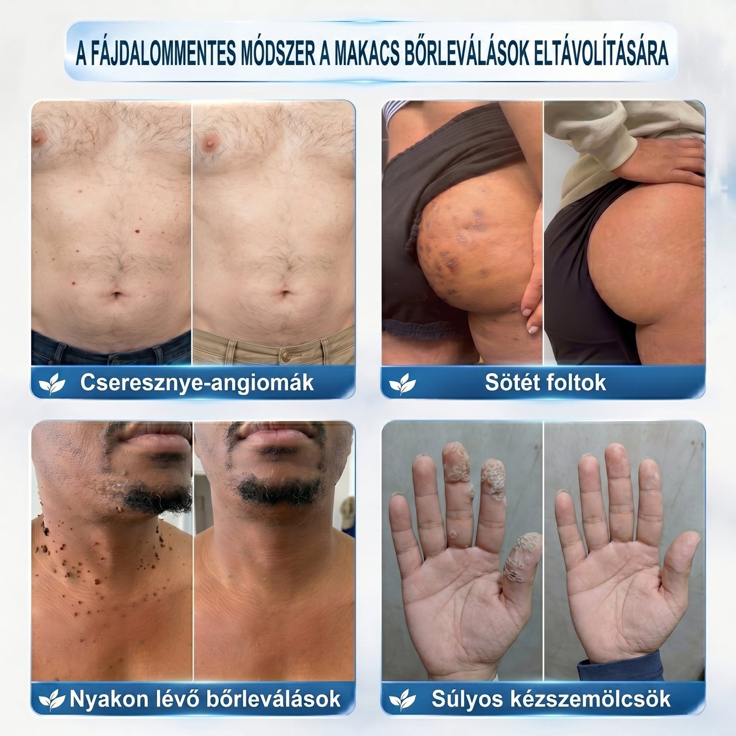 🖋️🌕𝐇𝐢𝐯𝐚𝐭𝐚𝐥𝐨𝐬 𝐦á𝐫𝐤𝐚𝐛𝐨𝐥𝐭  Creawel®   𝟕 𝐍𝐚𝐩𝐨𝐬 𝐁ő𝐫𝐤𝐢𝐧ö𝐯é𝐬- é𝐬 𝐅𝐨𝐥𝐭𝐫𝐚𝐝í𝐫(Fájdalommentes, nyommentes roll-on)