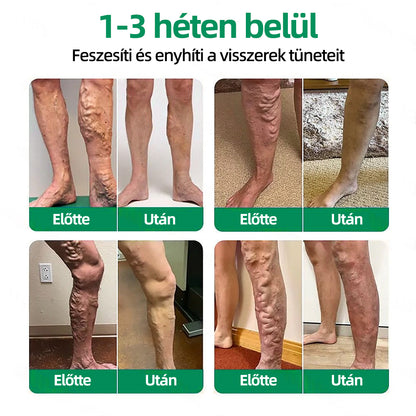 🇭🇺👩‍⚕️✅𝐇𝐞𝐚𝐥𝐫𝐢𝐳𝐞® VeinTarget mikrotűs tapasz⚡Azonnali enyhülés hosszú távú eredmények🔝