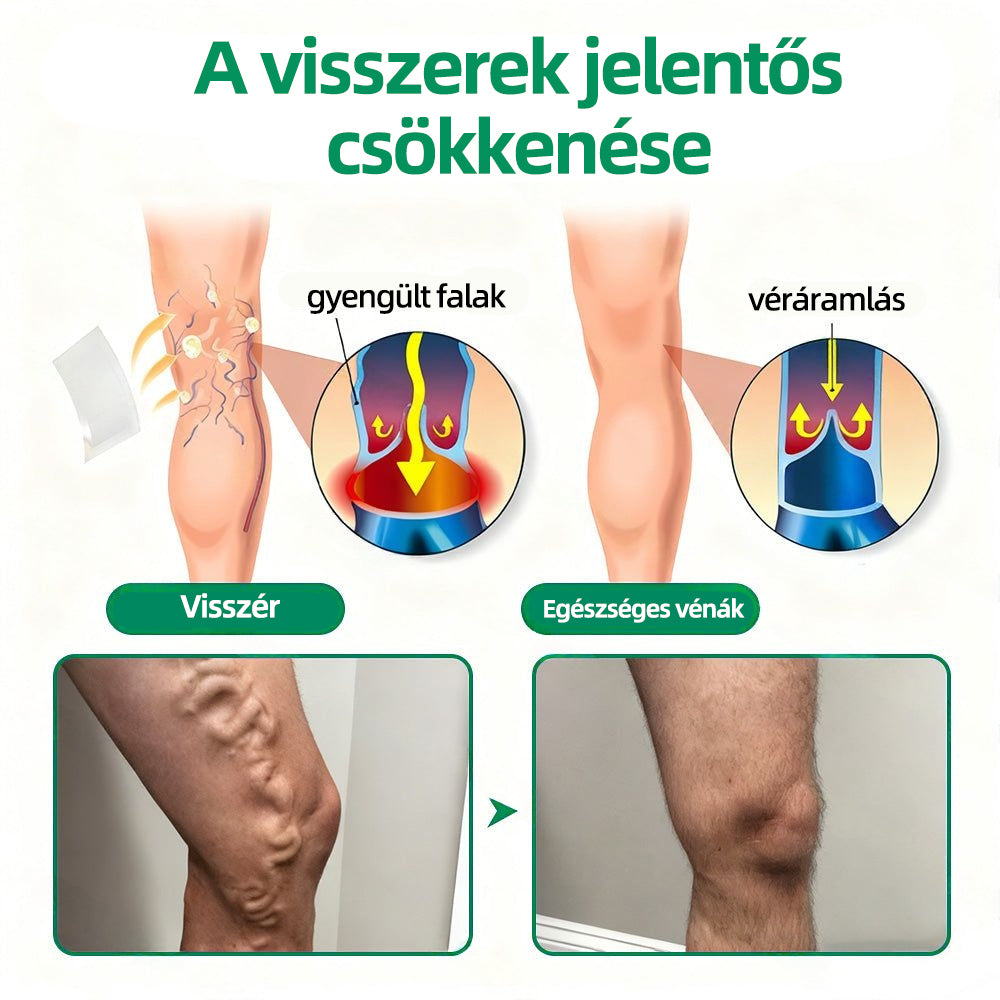 🇭🇺👩‍⚕️✅𝐇𝐞𝐚𝐥𝐫𝐢𝐳𝐞® VeinTarget mikrotűs tapasz⚡Azonnali enyhülés hosszú távú eredmények🔝