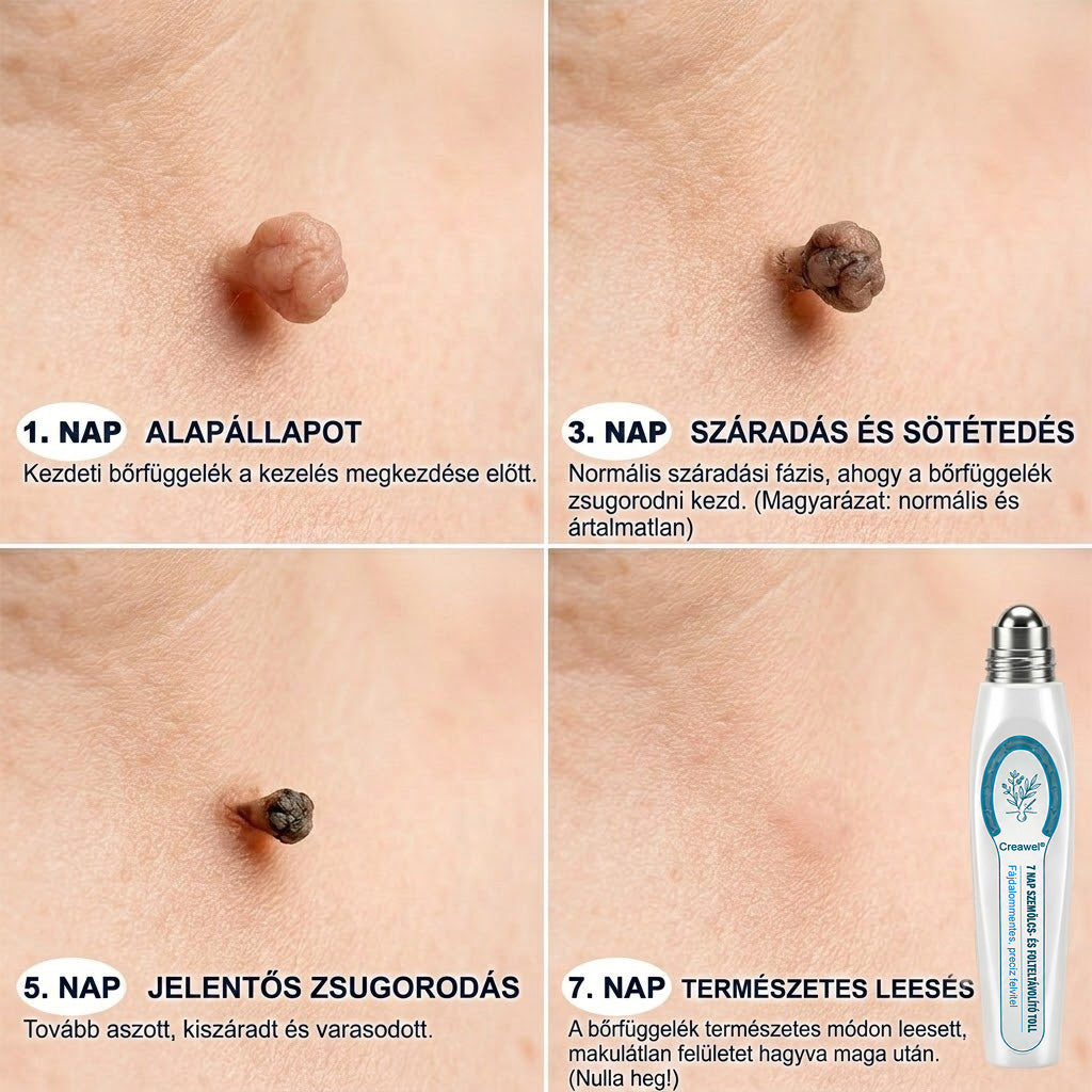 🖋️🌕𝐇𝐢𝐯𝐚𝐭𝐚𝐥𝐨𝐬 𝐦á𝐫𝐤𝐚𝐛𝐨𝐥𝐭  Creawel®   𝟕 𝐍𝐚𝐩𝐨𝐬 𝐁ő𝐫𝐤𝐢𝐧ö𝐯é𝐬- é𝐬 𝐅𝐨𝐥𝐭𝐫𝐚𝐝í𝐫(Fájdalommentes, nyommentes roll-on)
