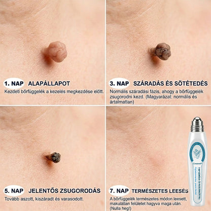 🖋️🌕𝐇𝐢𝐯𝐚𝐭𝐚𝐥𝐨𝐬 𝐦á𝐫𝐤𝐚𝐛𝐨𝐥𝐭  Creawel®   𝟕 𝐍𝐚𝐩𝐨𝐬 𝐁ő𝐫𝐤𝐢𝐧ö𝐯é𝐬- é𝐬 𝐅𝐨𝐥𝐭𝐫𝐚𝐝í𝐫(Fájdalommentes, nyommentes roll-on)