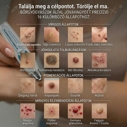 🖋️🌕𝐇𝐢𝐯𝐚𝐭𝐚𝐥𝐨𝐬 𝐦á𝐫𝐤𝐚𝐛𝐨𝐥𝐭  Creawel®   𝟕 𝐍𝐚𝐩𝐨𝐬 𝐁ő𝐫𝐤𝐢𝐧ö𝐯é𝐬- é𝐬 𝐅𝐨𝐥𝐭𝐫𝐚𝐝í𝐫(Fájdalommentes, nyommentes roll-on)