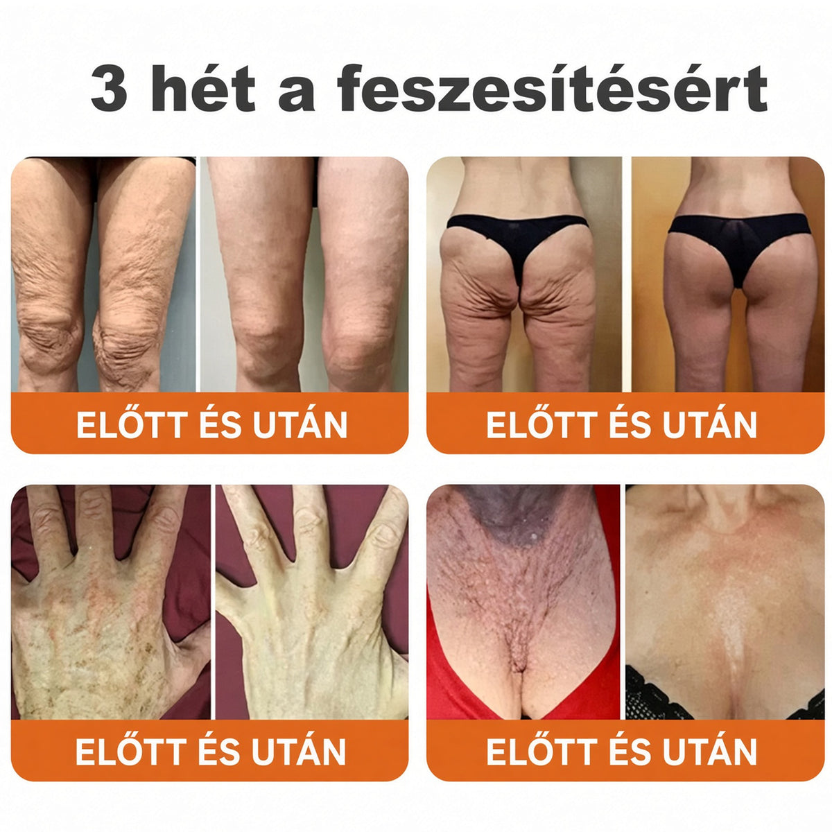 🔥  LIMITÁLT AJÁNLAT 👨‍⚕️🐝🌿 60% KEDVEZMÉNY | CureVivo® Méhméreg Bőrápoló Krém🐟3️⃣
