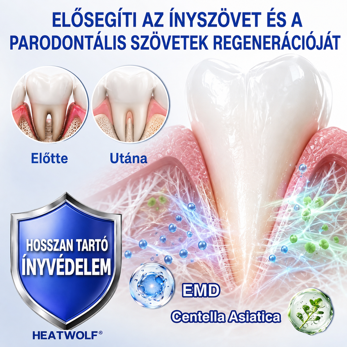 🇭🇺👨‍⚕️✅🦷 HEATWOLF® GumRevive – Parodontális helyreállító gél✨2️⃣